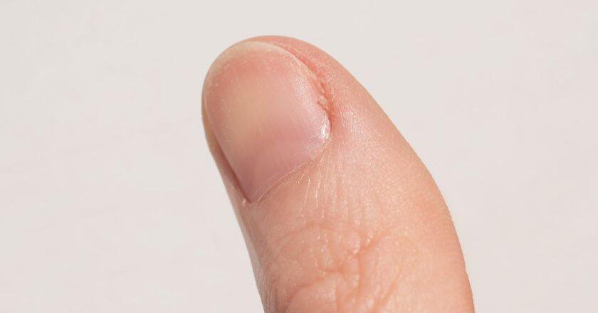 A Subtle Change in Your Nail Colour Could Indicate Health Issues
